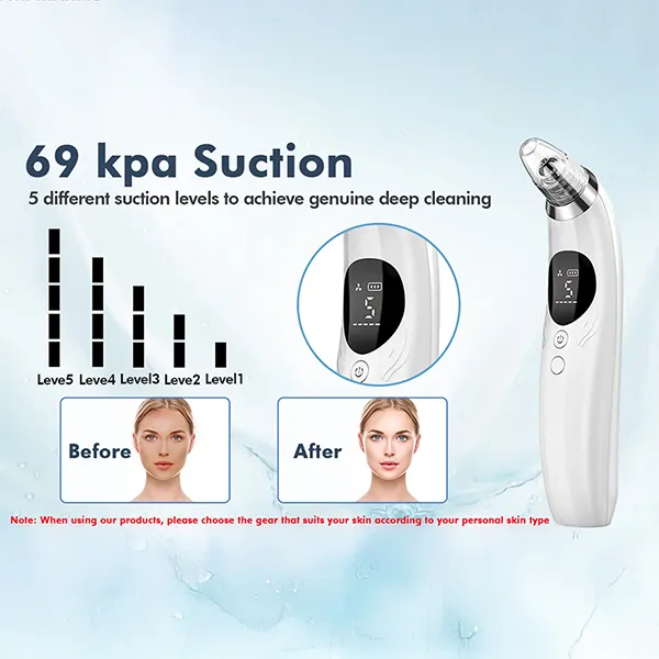 BlaRevia Blackhead Removers