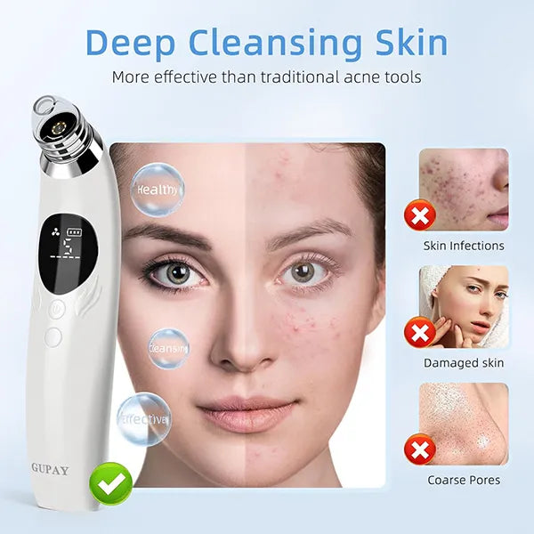 BlaRevia Blackhead Removers