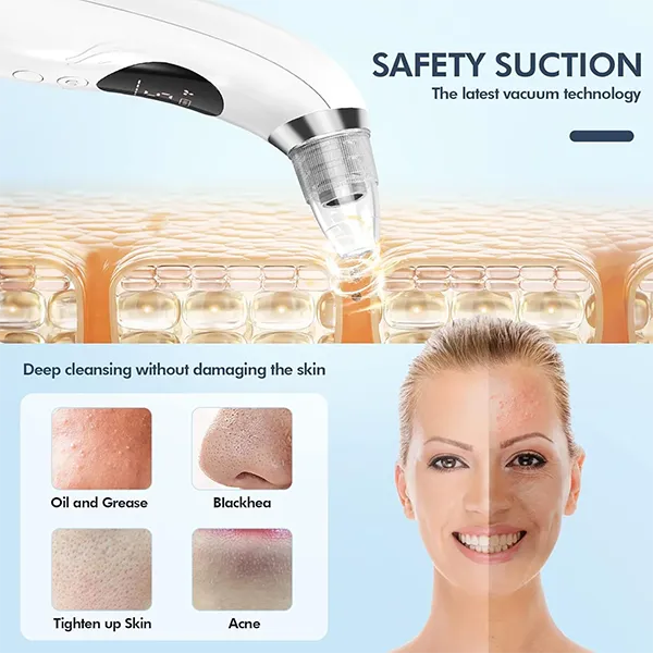 BlaRevia Blackhead Removers