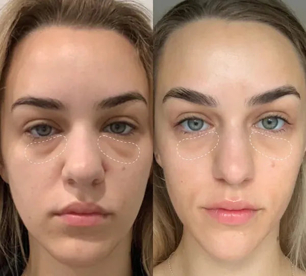 Revachol Bakuchiol Serums AU2