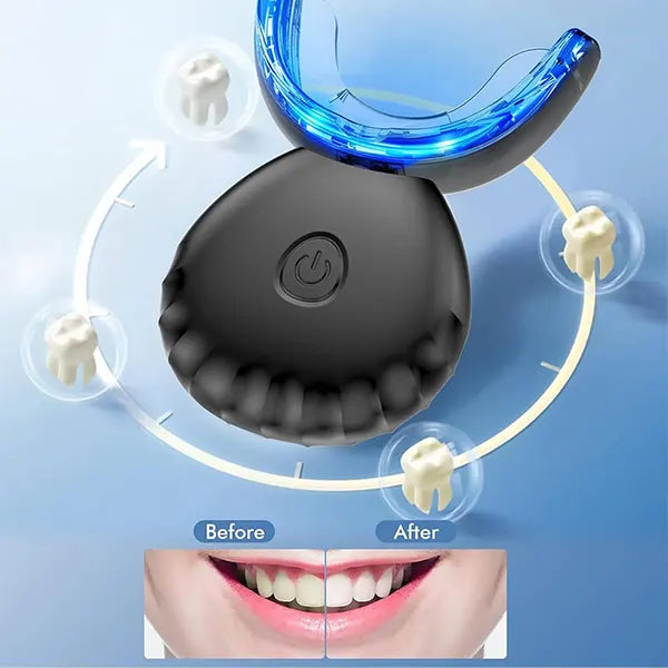 X7WTee Teeth Whitening Kit